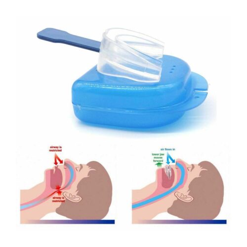 3x Anti Snoring Aid Mouth Guard Adjustable Mouthguard Sleeping and Breathing - Image 4
